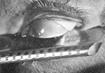 Кадр из фильма Луиса Бунюэля и Сальвадора Дали 'Андалузский пес' с сайта www.boijmans.rotterdam.nl