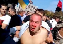 Избиение Нестора Шуфрича в Одессе. Кадр видео с youtube-канала Юрия Козариза