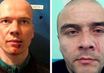 Ильдар Дадин и его сокамерник после драки. Источник: ptzgovorit.ru