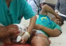 Раненый после стрельбы на юге Венесуэлы. Кадр видео из твиттера @AmericoDeGrazia