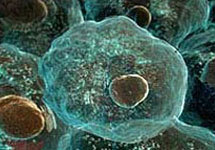 Стволовые клетки - надежда регенеративной медицины. Фото с сайта ВВС
