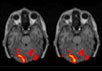 Иллюстрация возможностей функциональной ЯМР-томографии
мозга с сайта www.fmrib.ox.ac.uk/images/PM-EPI.gif