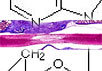 Схема молекулы с сайта
en.wikipedia.org/wiki/Cyclic_adenosine_monophosphate. Изображение контуженного участка
спинного мозга к