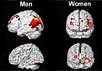 Работа мужского и женского мозга. Изображения с сайта today.uci.edu