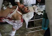 Раненый в Ираке. Фото АР