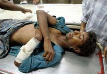 пострадавший в результате взрывов в Бангладеш. Фото с сайта YahooNews