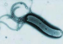 Helicobacter pylori. С сайта www.shef.ac.uk