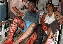 Раненые при теракте в Гувахати . Фото с сайта AFP