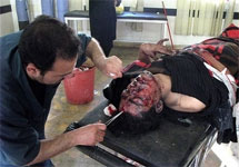 Раненый при теракте в Багдаде. Фото АР