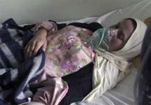 Отравленная хлором иракская женщина. Фото с сайта YahooNews