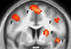 "Цепь ненависти" мозга - области, которые активизируются, когда человек видит своего врага. Изображение получено с помощью метода функциональной магнитно-резонансной томографии. F - лобная кора; P - путамен; I - инсулярная кора. Фото UCL с сайта NewScient