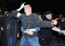 Столкновения с полицией в Тбилиси. Фото Reuters