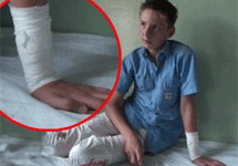Раненый семиклассник. Фото Life.ru