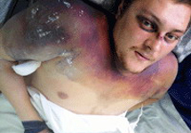 Избитый Денис Выржиковский перед смертью. Фото: openinform.ru
