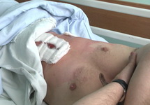 Раненый оперативник в больнице Херсона. Фото: mvs.gov.ua