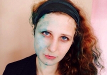 Мария Алехина после нападения в Явасе. Фото из ее твиттера