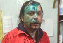 Андрей Юров после нападения. Фото Ольги Музыки