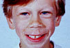 Мальчик с синдромом Вильямса. Фото с сайта medgen.genetics.utah.edu/photographs/pages/williams.htm