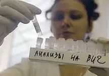 Анализы на ВИЧ-инфекцию. Фото: aids.ru