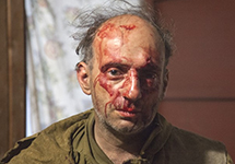 Михаил Крейндлин после нападения. Фото: greenpeace.org