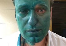 Алексей Навальный после нападения. Фото из личного твиттера
