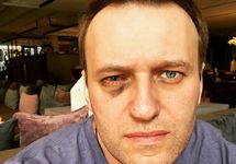 Алексей Навальный после операции. Фото из личного Инстаграма