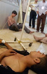 Пострадавшие в коридоре одного из багдадских госпиталей. Фото АР