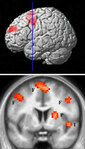 'Цепь ненависти' мозга - области, которые активизируются, когда человек видит своего врага. Изображение получено с помощью метода функциональной магнитно-резонансной томографии. F - лобная кора; P - путамен; I - инсулярная кора. Фото UCL с сайта NewScient