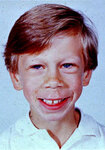 Мальчик с синдромом Вильямса. Фото с сайта medgen.genetics.utah.edu/photographs/pages/williams.htm