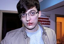 Константин Зыков после нападения. Фото с ФБ-страницы Александра Попкова