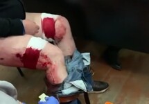 Раненому Марату Динаеву накладывают повязки. Кадр видео с youtube-канала "Отряды Путина Soc Sprav"
