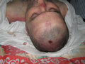 Тело Тархана Картоева со следами пыток. Фото с сайта pravo-ural.ru