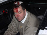 Евгений Доможиров после нападения 10 января 2013 года