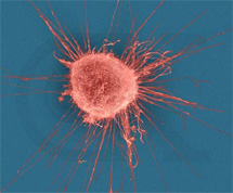 Раковая клетка. Фото с сайта www.alternative-cancer.net